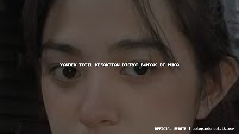 yandex tocil kesakitan dicrot banyak di muka